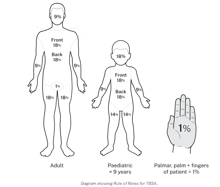 https://www.vicburns.org.au/files/general/Rule_of_nines_diagram.png